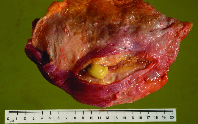 Carcase showing an abscess. Image copyright of Andy Grist, University of Bristol.